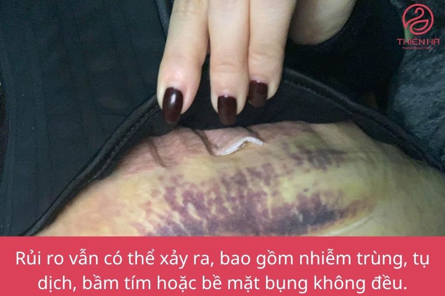 Rủi ro có thể xảy ra 