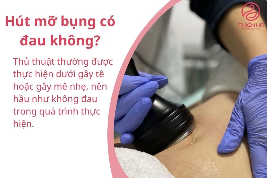 Một số câu hỏi thường gặp về hút mỡ bụng 