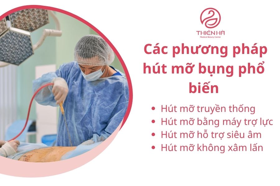 Các phương pháp hút mỡ bụng phổ biến