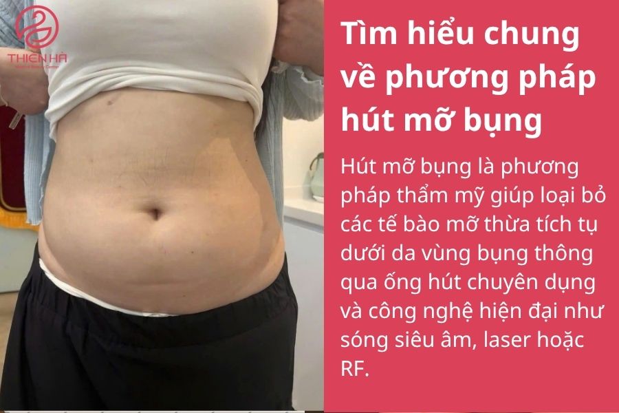 Tìm hiểu chung về phương pháp hút mỡ bụng