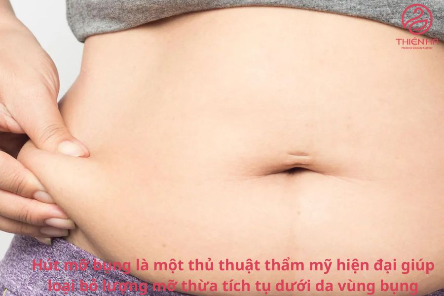 Hút mỡ bụng là gì ?