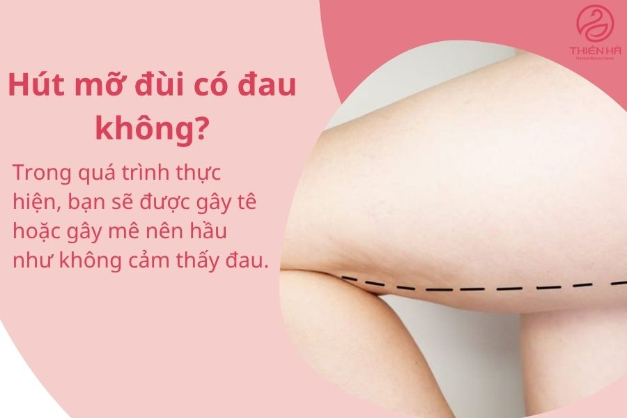 Một số câu hỏi thường gặp về hút mỡ đùi 