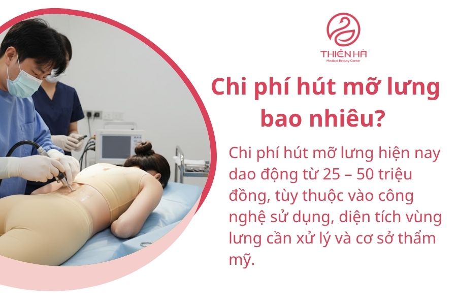 Chi phí hút mỡ lưng