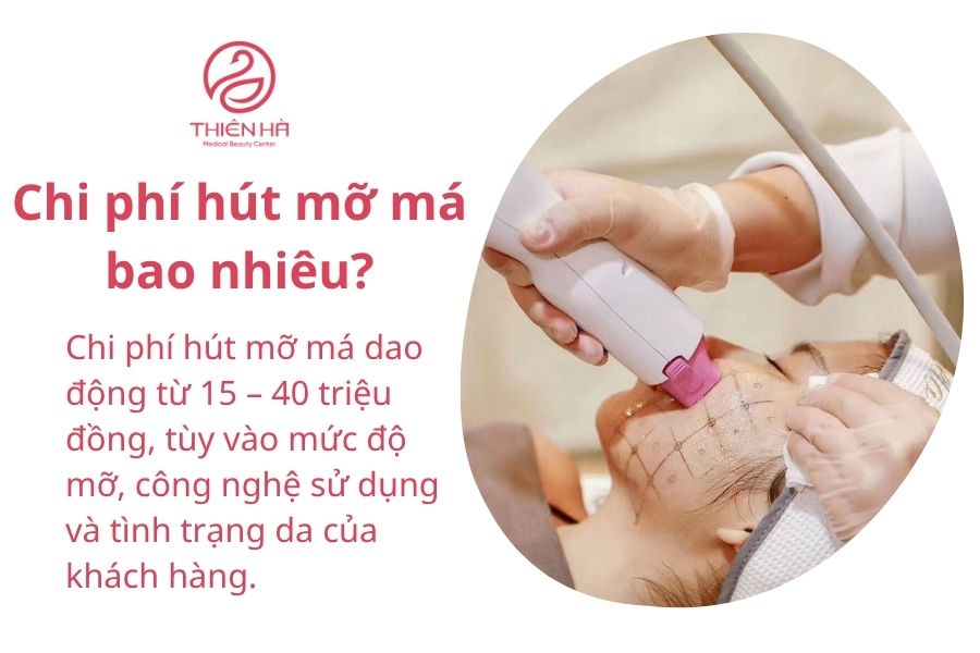 Chi phí hút mỡ má bao nhiêu?