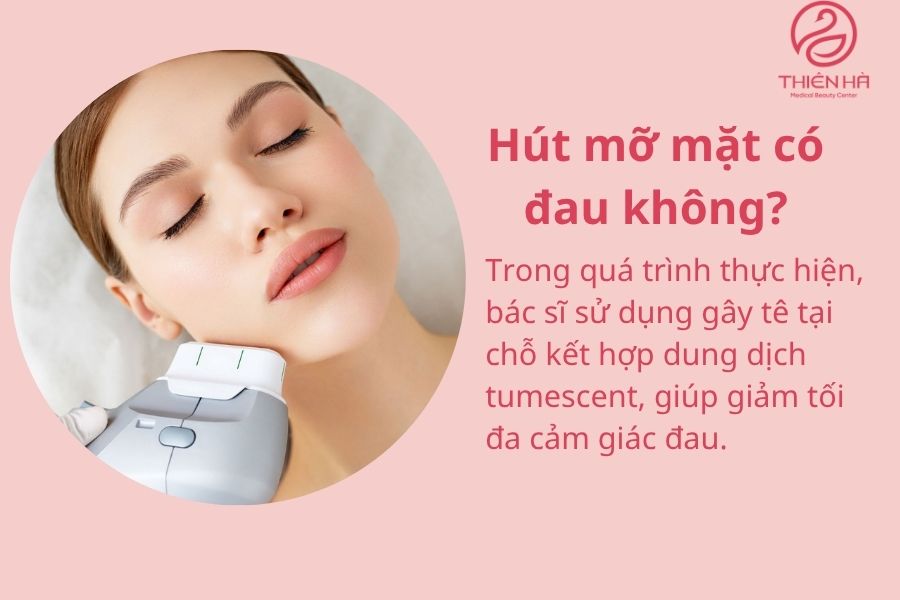 Một số câu hỏi thường gặp về hút mỡ mặt 