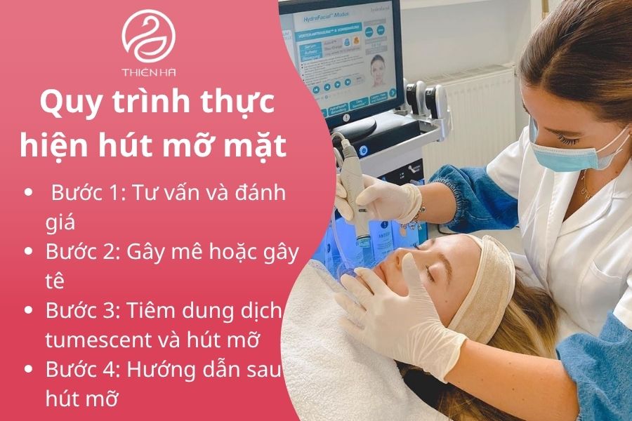 Quy trình thực hiện hút mỡ mặt 