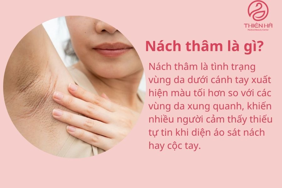 Nách thâm là gì?