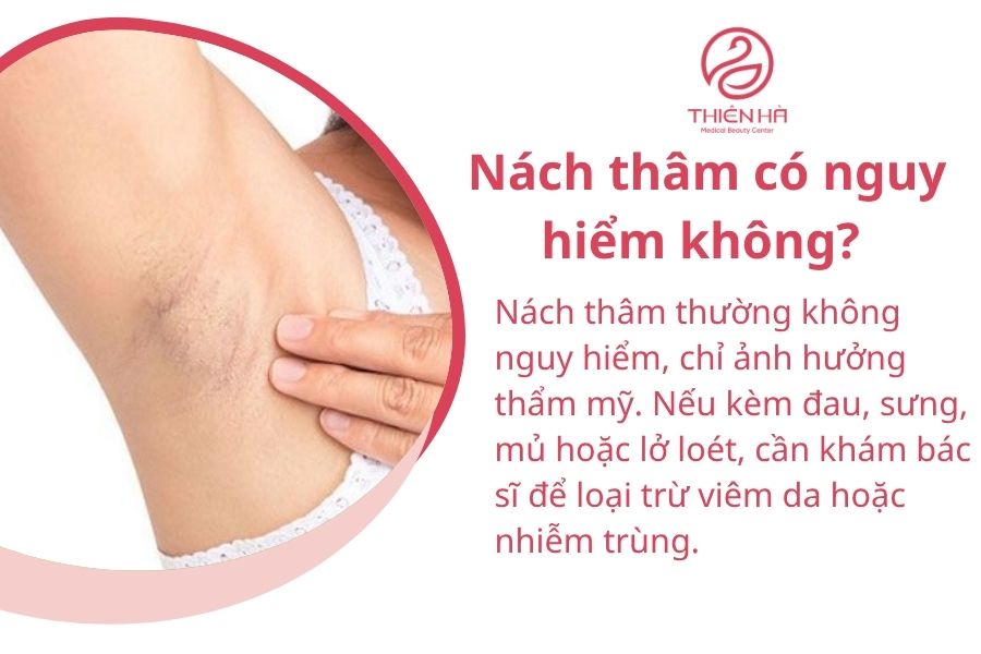 Một số câu hỏi thường gặp về nách thâm 