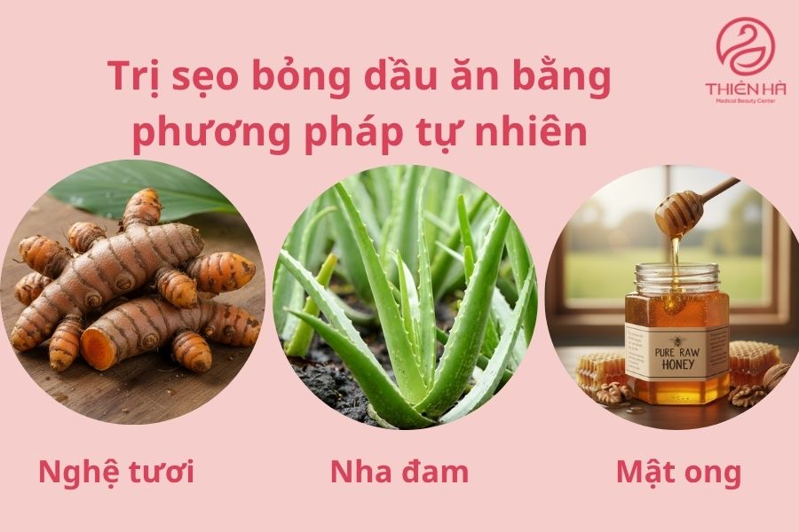 Cách trị sẹo bỏng dầu ăn bằng phương pháp tự nhiên 