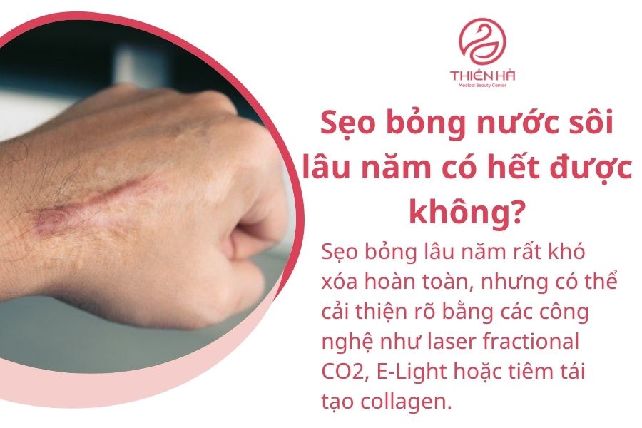 Một số câu hỏi thường gặp 