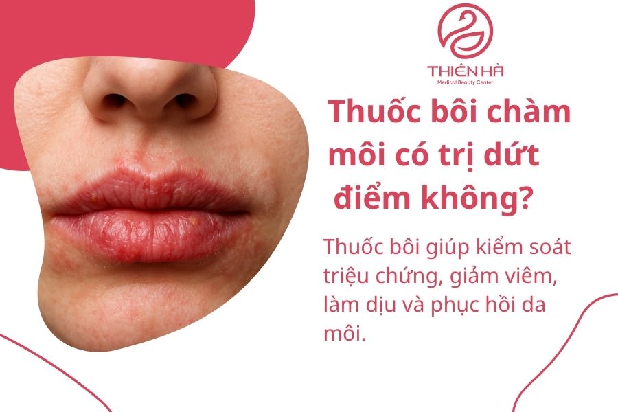 Một số câu hỏi thường gặp về thuốc bôi chàm môi 