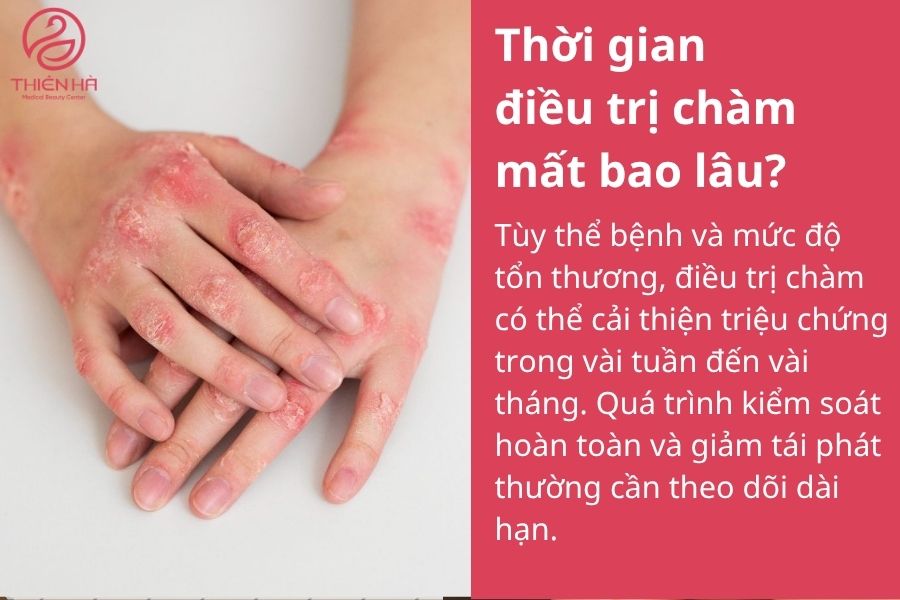 Một số câu hỏi thường gặp 