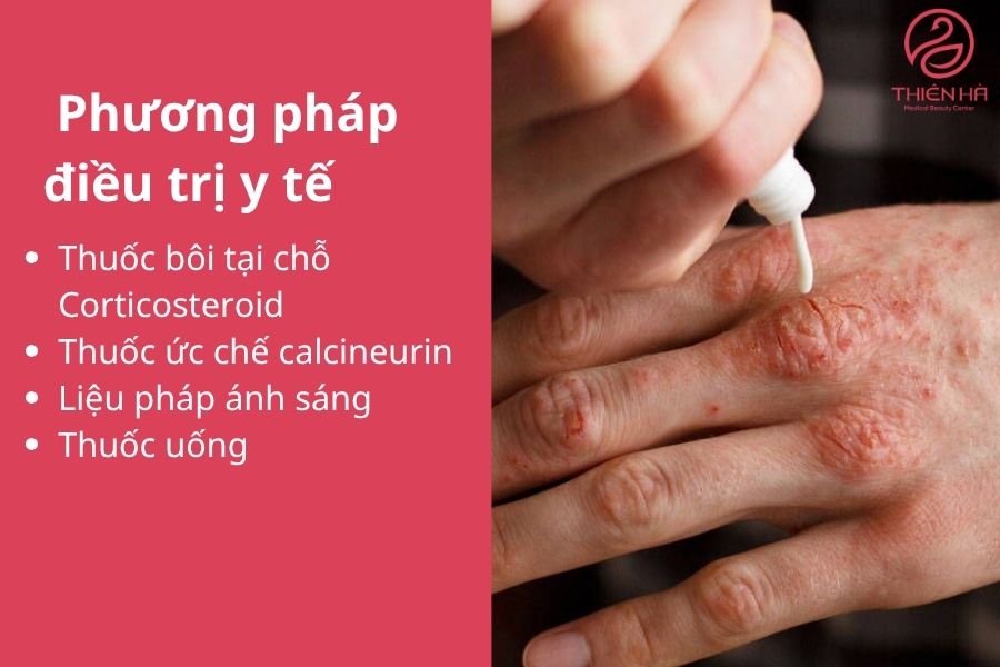Thuốc bôi tại chỗ