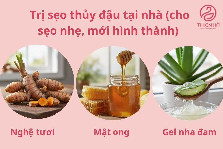 Cách trị sẹo thủy đậu tại nhà (cho sẹo nhẹ, mới hình thành)