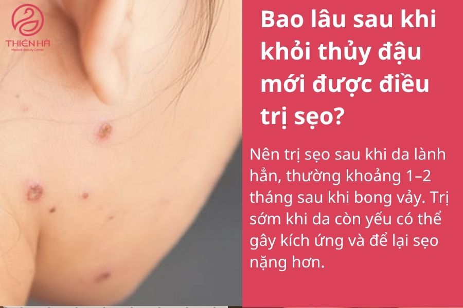 Một số câu hỏi thường gặp