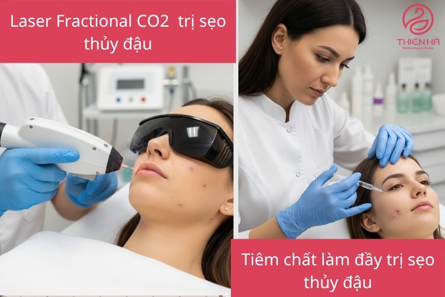 Trị sẹo thủy đậu bằng công nghệ y khoa hiện đại
