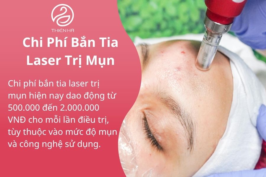 Chi phí bắn tia laser trị mụn bao nhiêu ? 