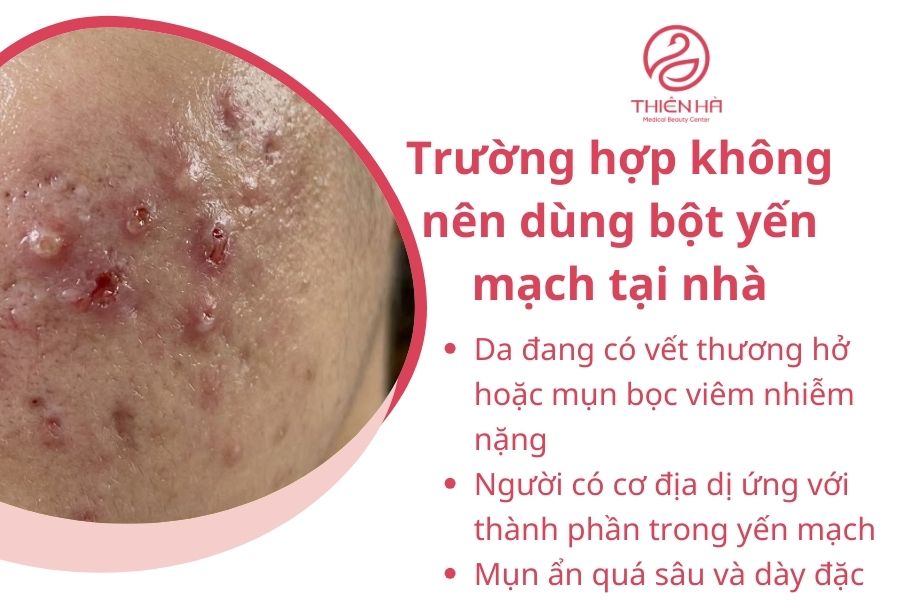 Trường hợp không nên dùng bột yến mạch tại nhà
