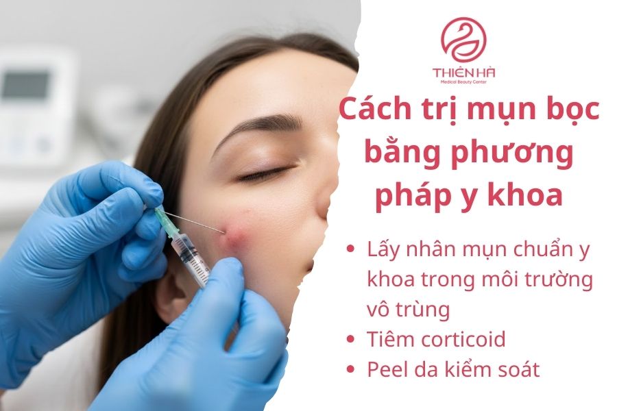 Cách trị mụn bọc bằng phương pháp y khoa 