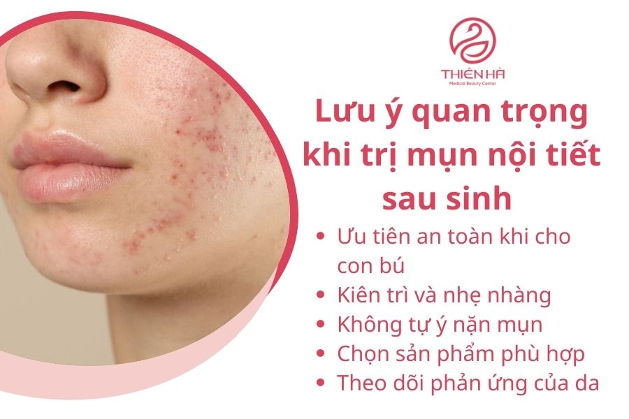 Lưu ý quan trọng khi trị mụn nội tiết sau sinh