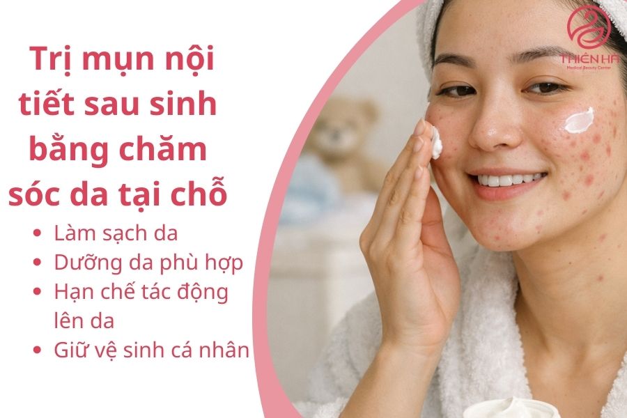 Trị mụn nội tiết sau sinh bằng cách chăm sóc da tại chỗ