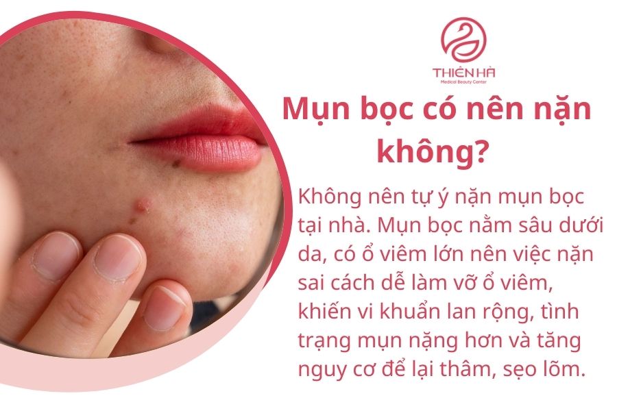 Một số câu hỏi thường gặp về mụn bọc 