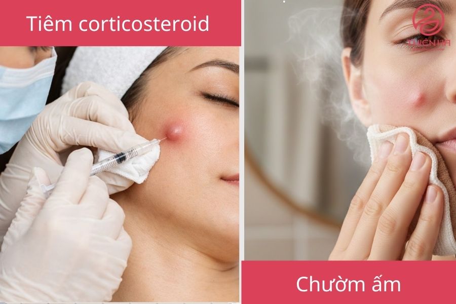 Cách xử lý và điều trị mụn bọc không đầu hiệu quả