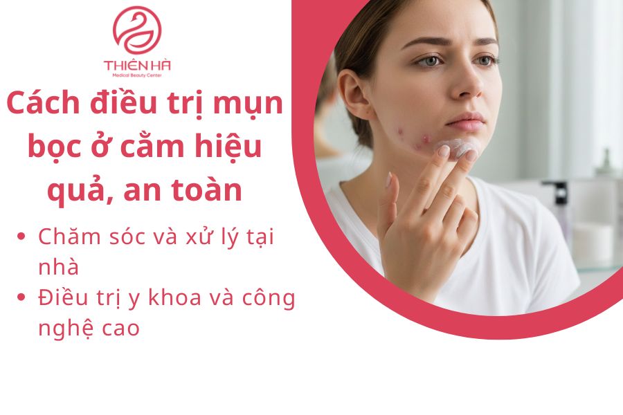Cách điều trị mụn bọc ở cằm hiệu quả, an toàn