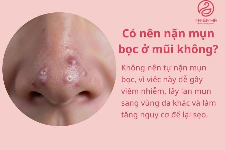 Câu hỏi thường gặp về mụn bọc ở mũi