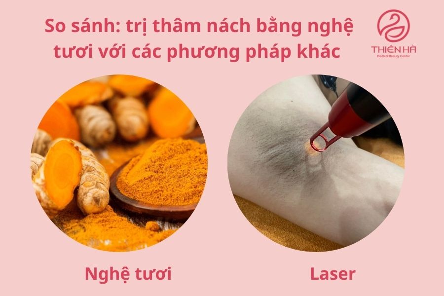So sánh: trị thâm nách bằng nghệ tươi vs các phương pháp khác
